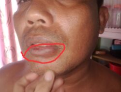 Lagi, Seorang Jurnalis Mengalami Penganiayaan Di Bolmong Utara