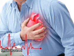 Indonesia Peringkat 2 Asia Kasus Gagal Jantung, Dokter Soroti Lemahnya Pengendalian Risiko